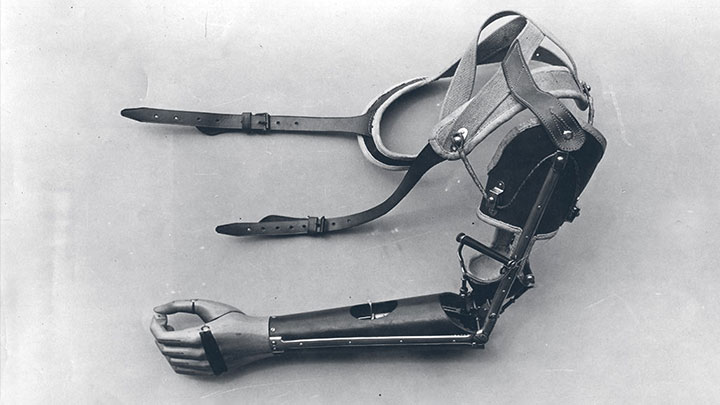 historische Armprothese